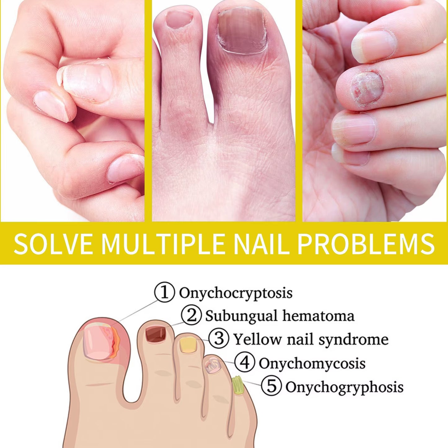 Cosmetics Rejuvenation Nail Growth Oil, Nail Oil for Growth and Strength Rejuvenation, Cosmetics Nail Growth Oil Rejuvenation