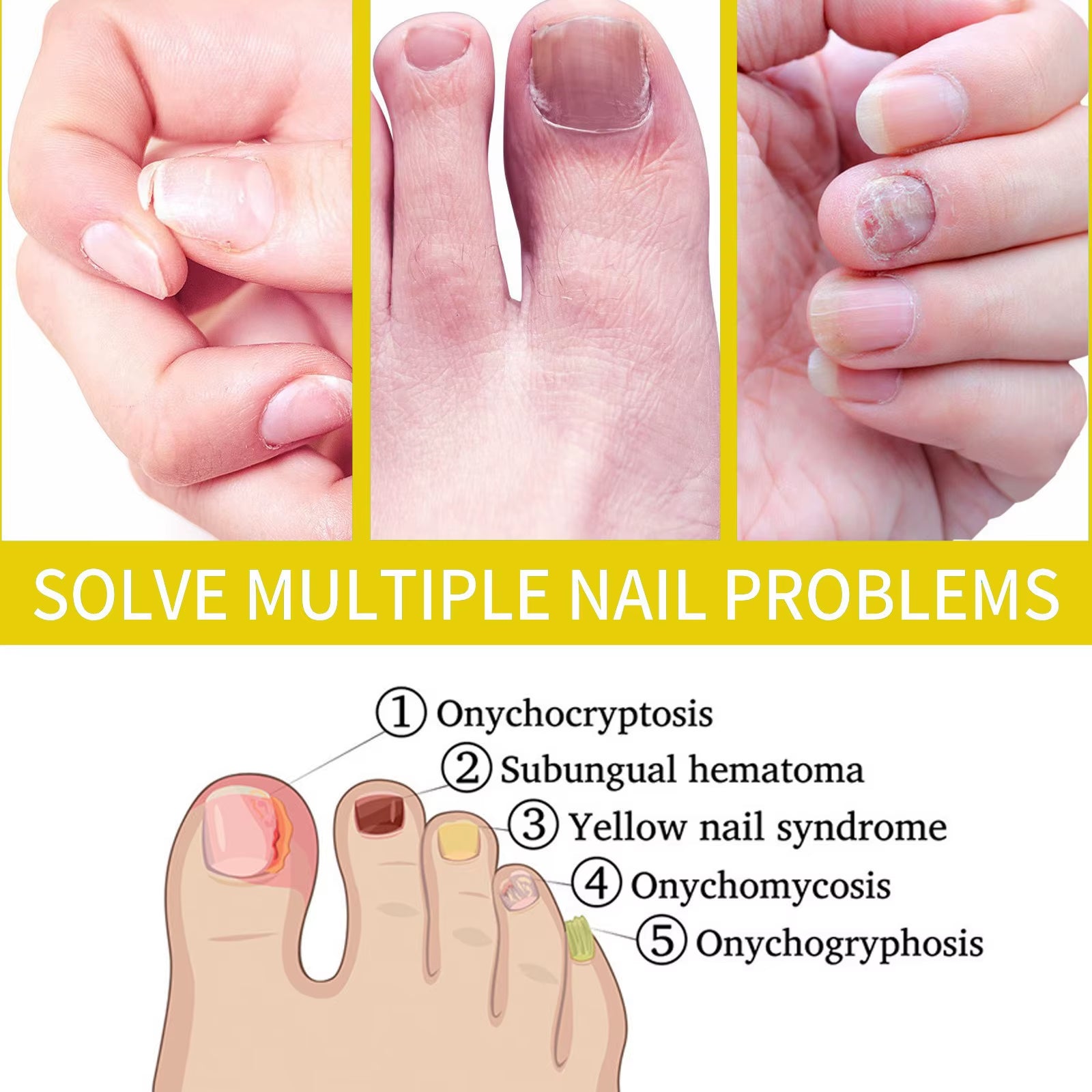 Cosmetics Rejuvenation Nail Growth Oil, Nail Oil for Growth and Strength Rejuvenation, Cosmetics Nail Growth Oil Rejuvenation