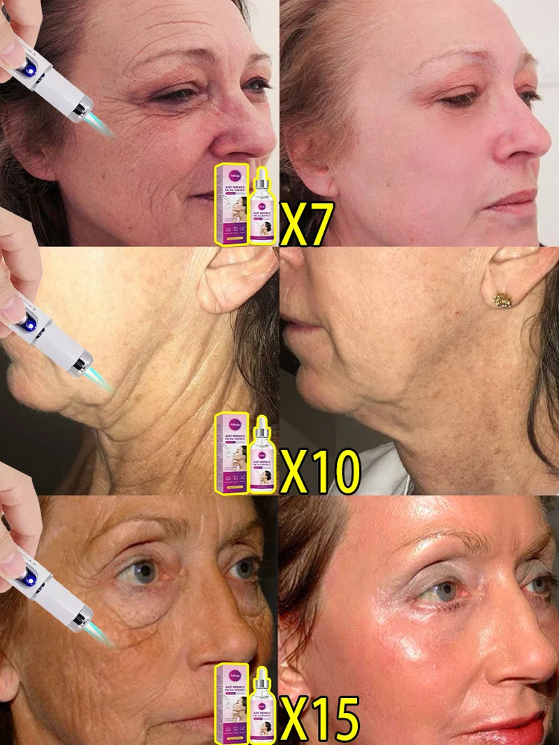 Facial Firming Elevator Korean Cosmetics